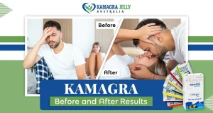Kamagra Before and After Results
